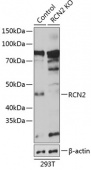[KO Validated] RCN2 Rabbit pAb (A19943)