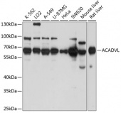 ACADVL Rabbit pAb (A7865)