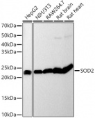 [KO Validated] SOD2 Rabbit mAb (A19576)