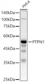 [KO Validated] PTPN1 Rabbit pAb (A22243)