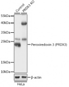 [KO Validated] Peroxiredoxin 3 (PRDX3) Rabbit pAb (A18061)