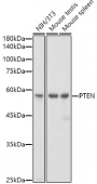 [KO Validated] PTEN Rabbit mAb (A19104)