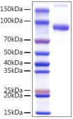 Recombinant Mouse Fc-gamma RIIB/CD32b Protein (RP01501)