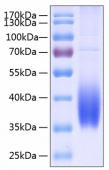 Active Recombinant Human B7-DC/PD-L2/CD273 Protein (RP00150)