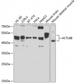 ACTL6B Rabbit pAb (A7108)