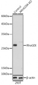 [KO Validated] RhoGDI Rabbit pAb (A1214)