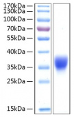 Active Recombinant Human BTN1A1/Butyrophilin Protein (RP00249)