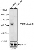 [KO Validated] PRMT4/CARM1 Rabbit pAb (A2246)
