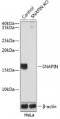 [KO Validated] SNAPIN Rabbit pAb (A19980)