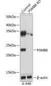 [KO Validated] PSMB8 Rabbit pAb (A19933)