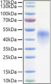 Recombinant Human Fc-gamma RIII alpha/CD16a(F176V) Protein (RP01366)