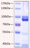 Active Recombinant Human AGER/RAGE Protein (RP00154)