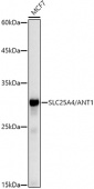 [KO Validated] SLC25A4/ANT1 Rabbit mAb (A20842)