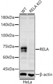 [KO Validated] RELA Rabbit pAb (A22684)