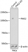 [KO Validated] PMS2 Rabbit pAb (A19927)