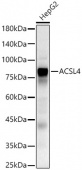 ACSL4 Rabbit pAb (A16848)