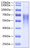 Active Recombinant Human B7-2/CD86 Protein (RP00090)