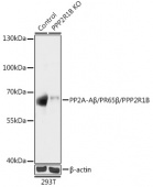 [KO Validated] PP2A-Aβ/PR65β/PPP2R1B Rabbit pAb (A18089)