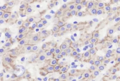 Anti - E Cadherin Rabbit Western Blot Immunohistochemistry immunofluorescence polyclonal antibody