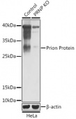 [KO Validated] Prion Protein Rabbit pAb (A18058)