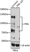 [KO Validated] PML Rabbit pAb (A1184)