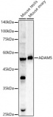 ADAM5 Rabbit pAb (A6196)