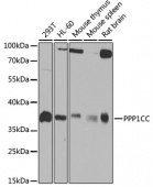 [KO Validated] PPP1CC Rabbit pAb (A4035)