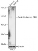[KO Validated] Sonic Hedgehog (Shh) Rabbit pAb (A18020)