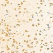 Anti - PKC beta 2 Rabbit pAb