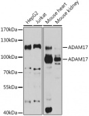 ADAM17 Rabbit pAb (A0821)