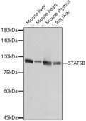 [KO Validated] STAT5B Rabbit pAb (A21613)