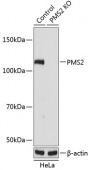 [KO Validated] PMS2 Rabbit pAb (A19928)