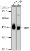 [KO Validated] SMARCB1/SNF5 Rabbit mAb (A23466)