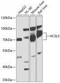 ACSL5 Rabbit pAb (A1270)
