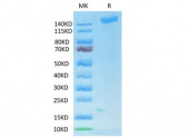 Biotinylated Recombinant SARS-COV-2 Spike S1+S2 ECD(S-ECD) Trimer Protein (RP02331)