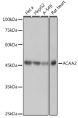ACAA2 Rabbit mAb (A0664)