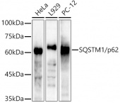 [KO Validated] SQSTM1/p62 Rabbit pAb (A21702)