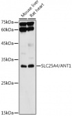 [KO Validated] SLC25A4/ANT1 Rabbit pAb (A1882)