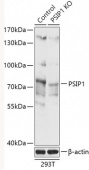 [KO Validated] PSIP1 Rabbit pAb (A18101)