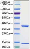 Active Recombinant Human FcRn Protein (RP01037)