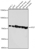 [KD Validated] ATG7 Rabbit mAb (A19604)