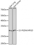 15-PGDH/HPGD Rabbit mAb (A5024)