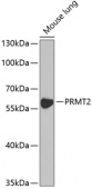 [KO Validated] PRMT2 Rabbit pAb (A5835)