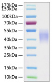 Recombinant Human Fc-gamma RIII beta/CD16b Protein (RP00291)