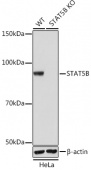 [KO Validated] STAT5B Rabbit mAb (A19567)