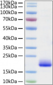 Active Recombinant Mouse IL-4 Protein (RP01161)