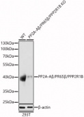 [KO Validated] PP2A-Aβ/PR65β/PPP2R1B Rabbit pAb (A21559)