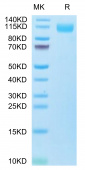 Biotinylated Recombinant SARS-CoV-2 Spike S1(B.1.1.529/Omicron) Protein (RP02109)