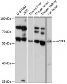 ACSF3 Rabbit pAb (A13769)