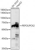 [KO Validated] PEPCK/PCK2 Rabbit pAb (A21529)